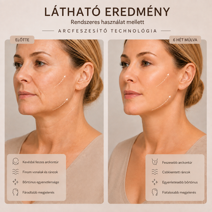 GeminiDerm™ -Dermalift Glow Professzionális Arcfeszesítő Eszköz