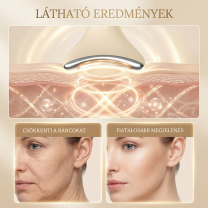 GeminiDerm™ -Dermalift Glow Professzionális Arcfeszesítő Eszköz